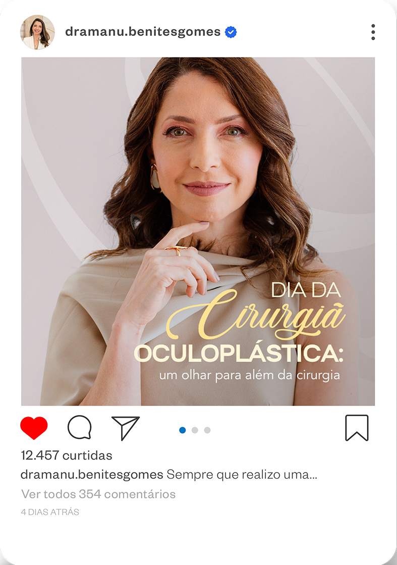 Imagem Post Instagram